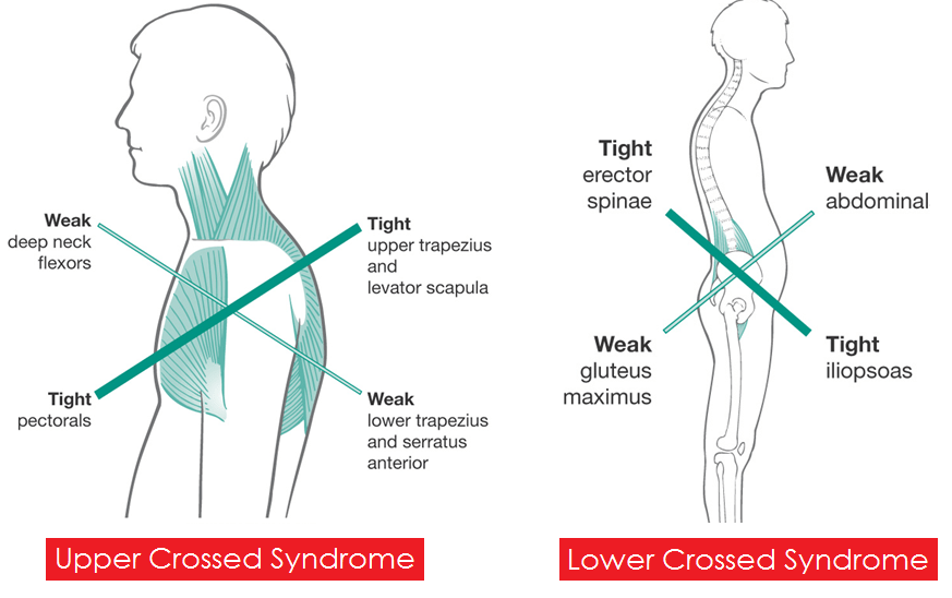 postural syndromes